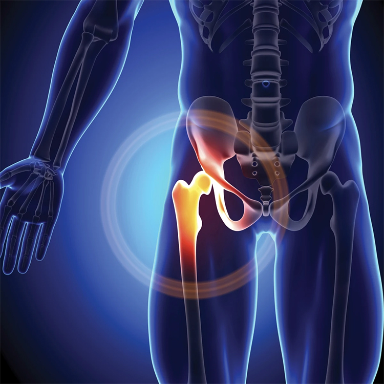 Hip Replacement Details